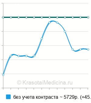 Средняя стоимость КТ мочевыделительной системы в Ростове-на-Дону