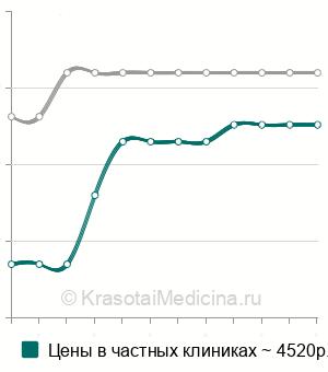 Средняя стоимость МРТ-холангиография в Ростове-на-Дону