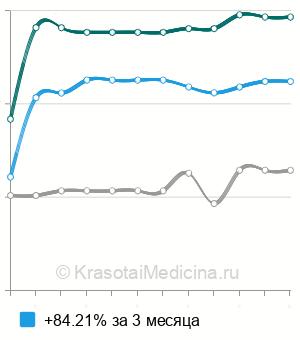 Средняя стоимость рентгенографии пальцев кисти в Ростове-на-Дону