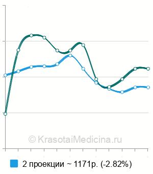 Средняя стоимость рентгенографии предплечья в Ростове-на-Дону