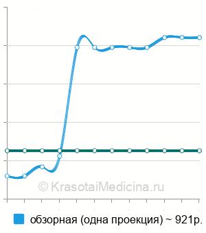 Средняя стоимость рентген грудной клетки в Ростове-на-Дону
