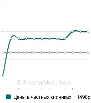 Средняя стоимость рентген лицевого скелета в Ростове-на-Дону
