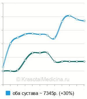 Средняя стоимость МРТ височно-нижнечелюстных суставов в Ростове-на-Дону