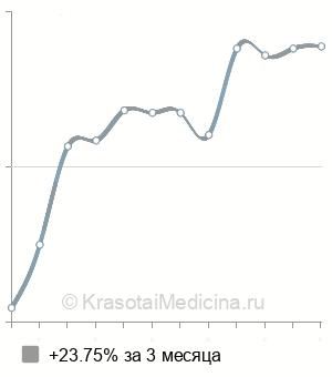 Средняя стоимость МРТ краниовертебрального перехода в Ростове-на-Дону
