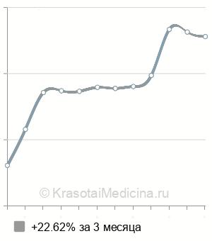 Средняя стоимость МРТ стопы в Ростове-на-Дону