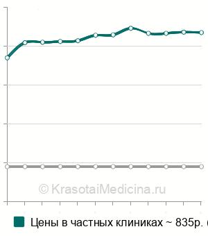 Средняя стоимость анализ крови на PAPP-A (ассоциированный с беременностью белок А) в Ростове-на-Дону