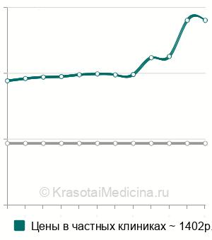 Средняя стоимость анализ на антинуклеарный фактор (АНФ) в Ростове-на-Дону