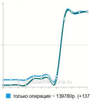 Средняя стоимость первичное тотальное эндопротезирование тазобедренного сустава в Ростове-на-Дону