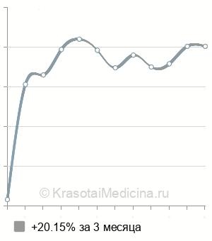 Средняя стоимость прием ортодонта в Ростове-на-Дону