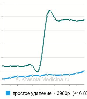 Средняя стоимость удаление постоянного зуба в Ростове-на-Дону