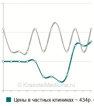 Средняя стоимость камертональное исследование слуха в Ростове-на-Дону