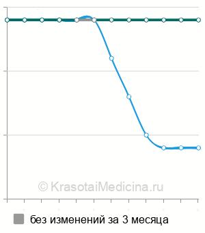 Средняя стоимость индуктотермия в Ростове-на-Дону