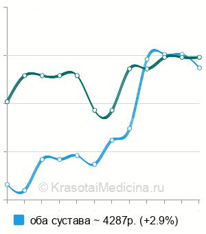 Средняя стоимость МРТ тазобедренного сустава в Ростове-на-Дону