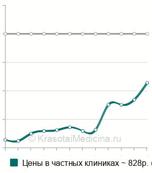 Средняя стоимость УЗИ околоносовых пазух в Ростове-на-Дону