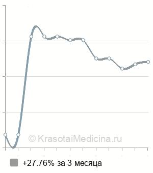 Средняя стоимость плацентарная терапия Curasen в Ростове-на-Дону