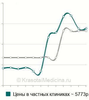Средняя стоимость эхогистеросальпингоскопия (УЗГСС) в Ростове-на-Дону