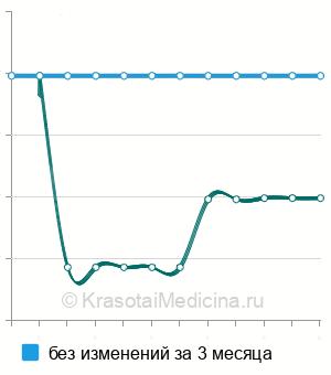 Средняя стоимость УЗИ прямой кишки в Ростове-на-Дону