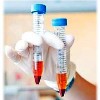 Плазмолифтинг области вокруг глаз